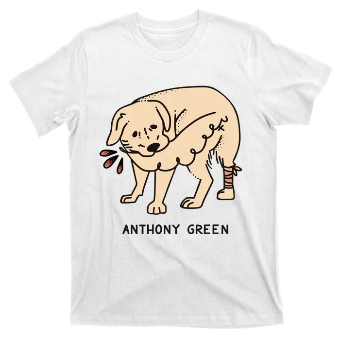 Anthony Green Numb T-Shirt