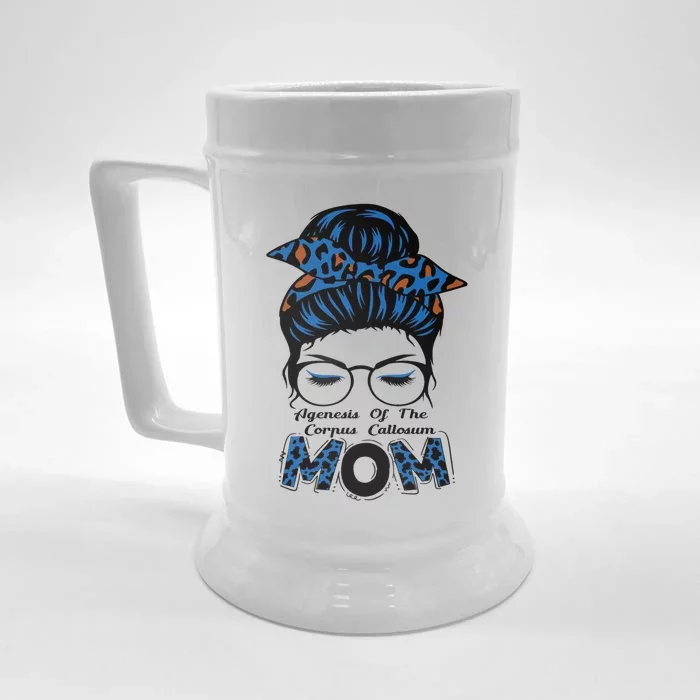 Agenesis Of The Corpus Callosum Strong Awareness Mom Great Gift Front & Back Beer Stein