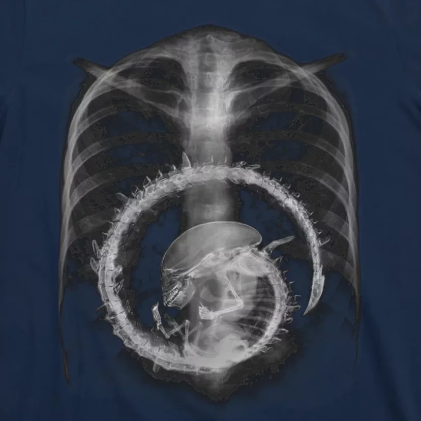 Alien Radiography T-Shirt