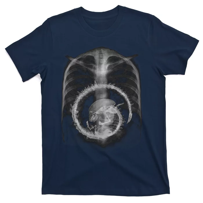 Alien Radiography T-Shirt