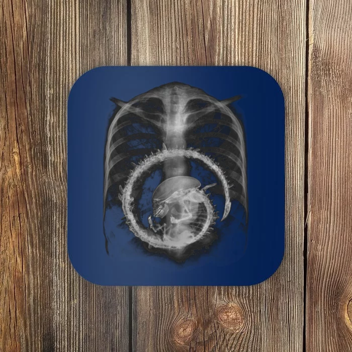 Alien Radiography Coaster