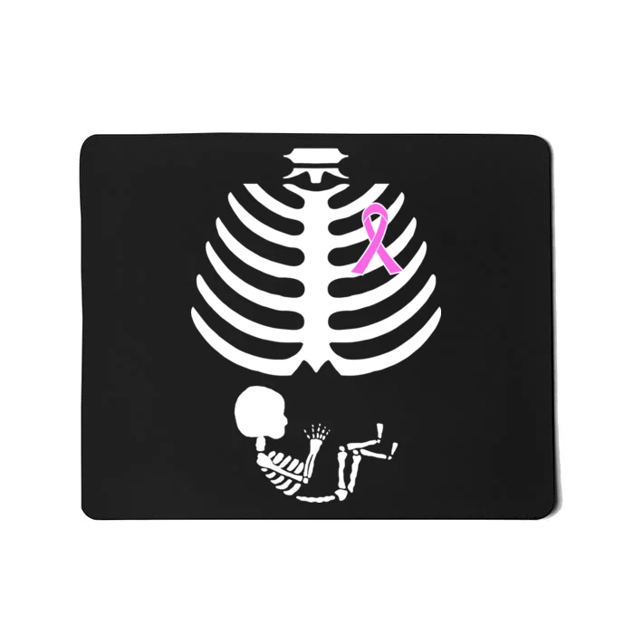 Baby Skeleton Breast Cancer Ribbon Mousepad