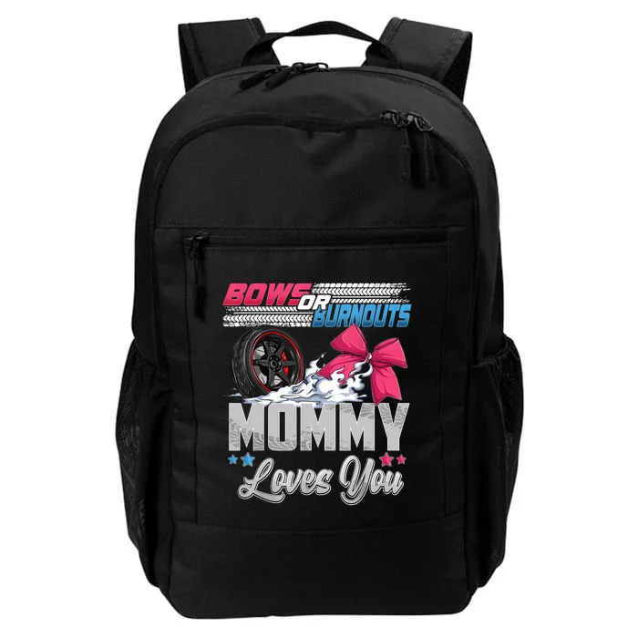 Burnouts Or Bows Gender Reveal Party Announcement Mommy Daily Commute Backpack