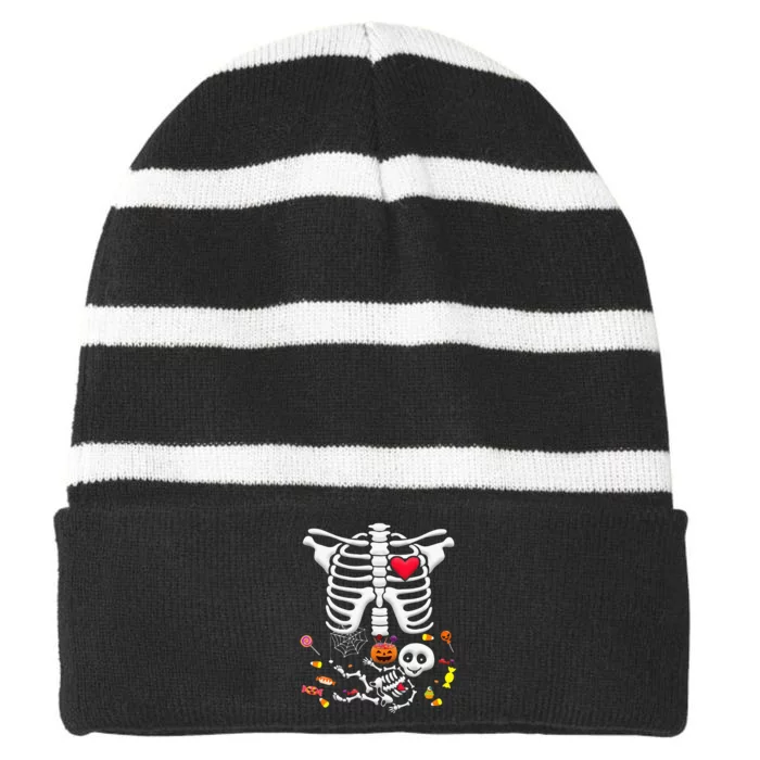 Baby Skeleton Candy Halloween Funny Pregnancy X Ray Striped Beanie with Solid Band