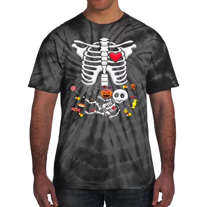 Baby Skeleton Candy Halloween Funny Pregnancy X Ray Tie-Dye T-Shirt