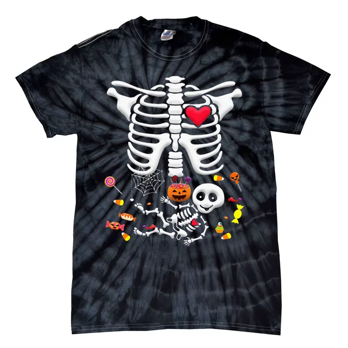 Baby Skeleton Candy Halloween Funny Pregnancy X Ray Tie-Dye T-Shirt