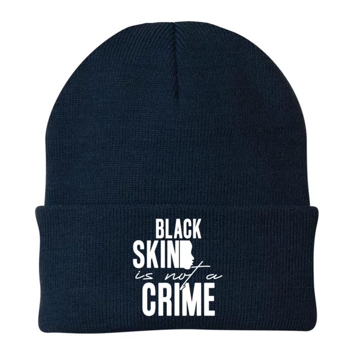 Black Skin Is Not A Crime Black Lives Matter Gift Knit Cap Winter Beanie