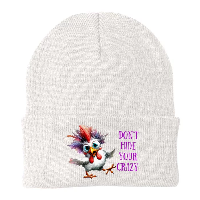 Chicken Don’T Hide Your Crazy Knit Cap Winter Beanie