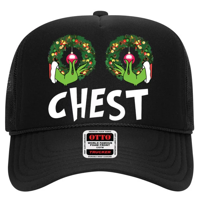 Chest Nuts Christmas Shirts Funny Matching Couple Chest Nuts High Crown Mesh Trucker Hat