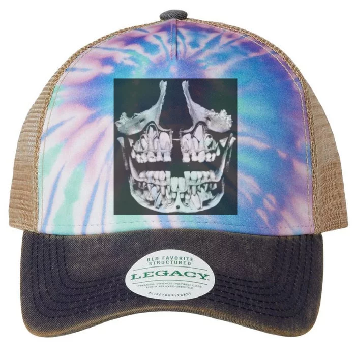 Darby Allin Hoodlum Teeth Legacy Tie Dye Trucker Hat