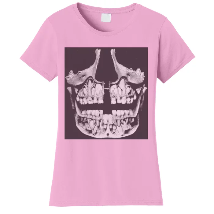 Darby Allin Hoodlum Teeth Women's T-Shirt