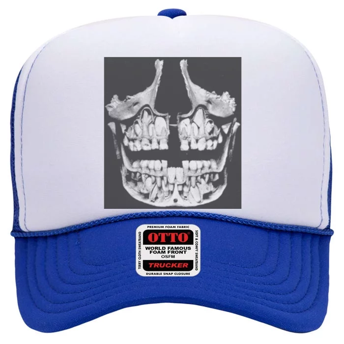 Darby Allin Hoodlum Teeth High Crown Mesh Trucker Hat