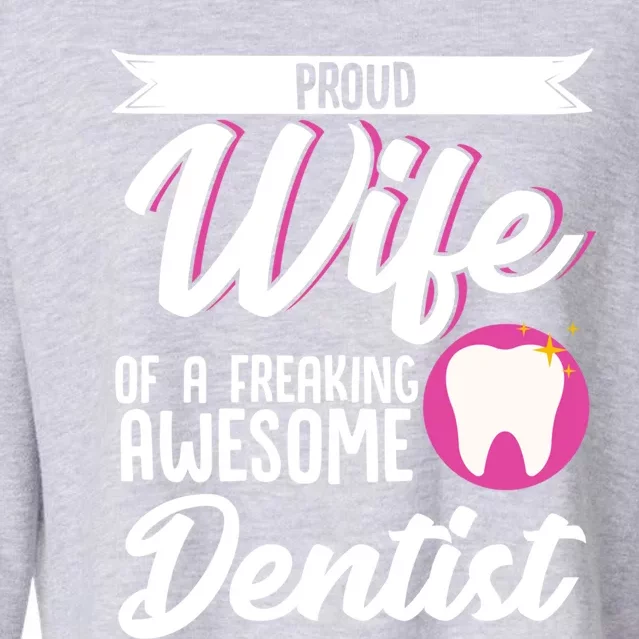 Dentist Wife Husband Dental Hygienist Couple Valentine’s Day Great Gift Cropped Pullover Crew