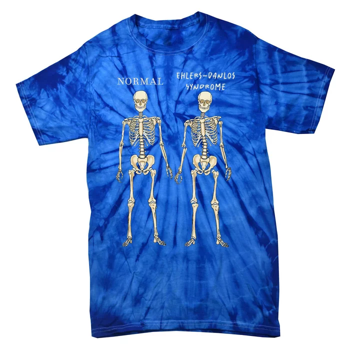 Ehlers Danlos Syndrome Skeletons Zebra Awareness Tie-Dye T-Shirt