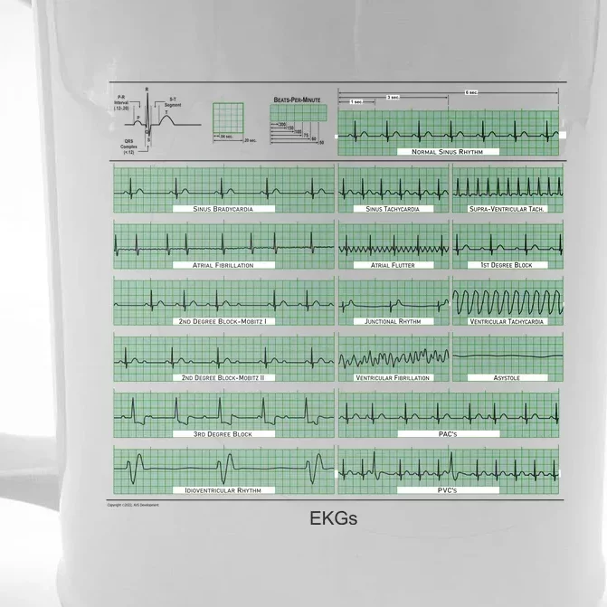 EKG Training Mug Front & Back Beer Stein