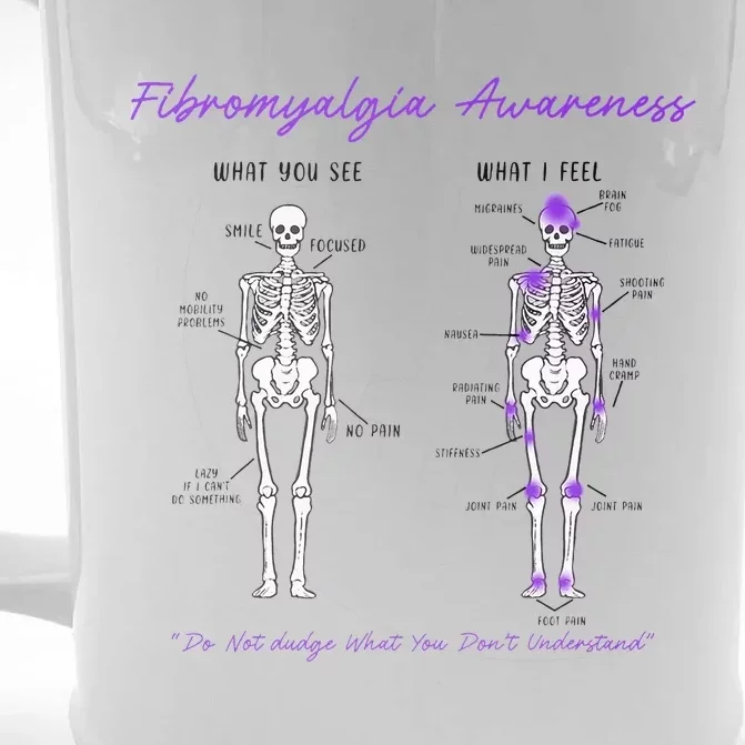 Fibromyalgia Awareness Skeleton People With Fibromyalgia Front & Back Beer Stein