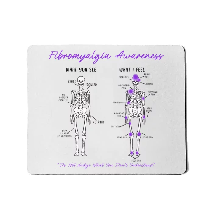 Fibromyalgia Awareness Skeleton People With Fibromyalgia Mousepad