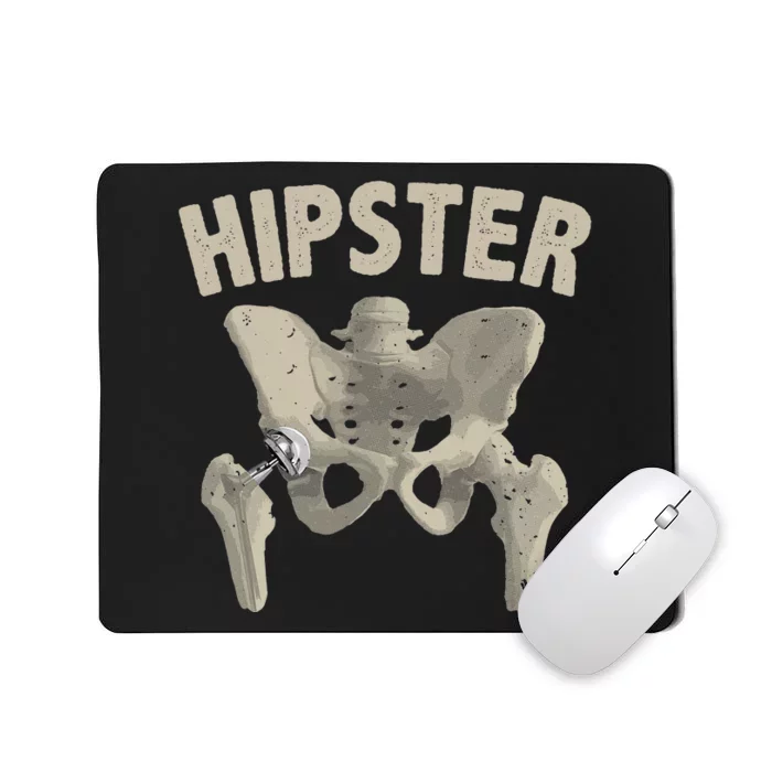 Funny Hip Surgery Gift  Hip Replacement Recovery Mousepad