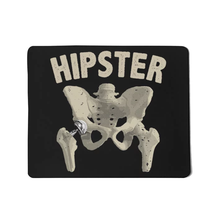 Funny Hip Surgery Gift  Hip Replacement Recovery Mousepad