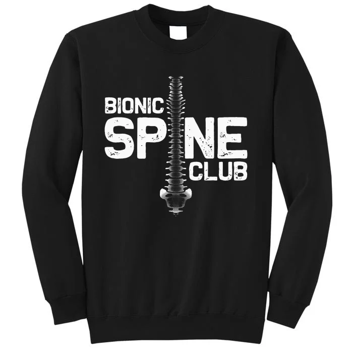 Funny Spine Surgery Gift For Men Women Bionic Spine Club Sweatshirt