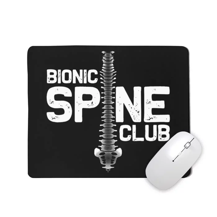 Funny Spine Surgery Gift For Men Women Bionic Spine Club Mousepad