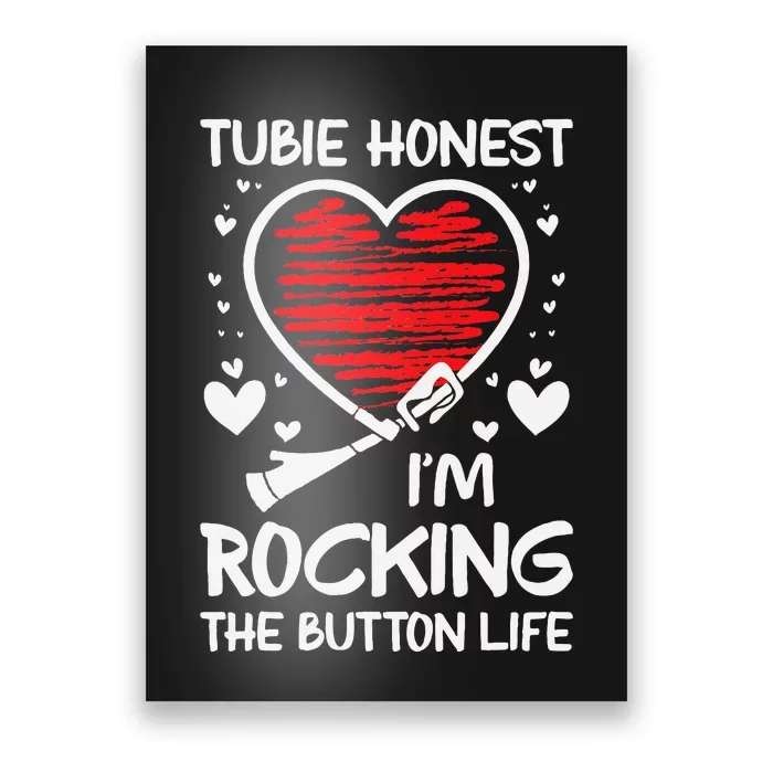 Gtube Accessories For Babies Feeding Tube Awareness G Tube Poster