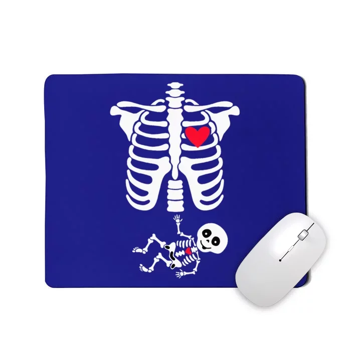 Halloween Costume for Pregnant Mom to Be Skeleton Mousepad