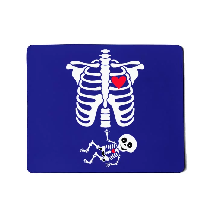 Halloween Costume for Pregnant Mom to Be Skeleton Mousepad