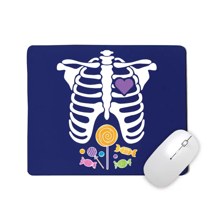 Halloween Candy Xray Skeleton Costume For Kids Boy Mousepad