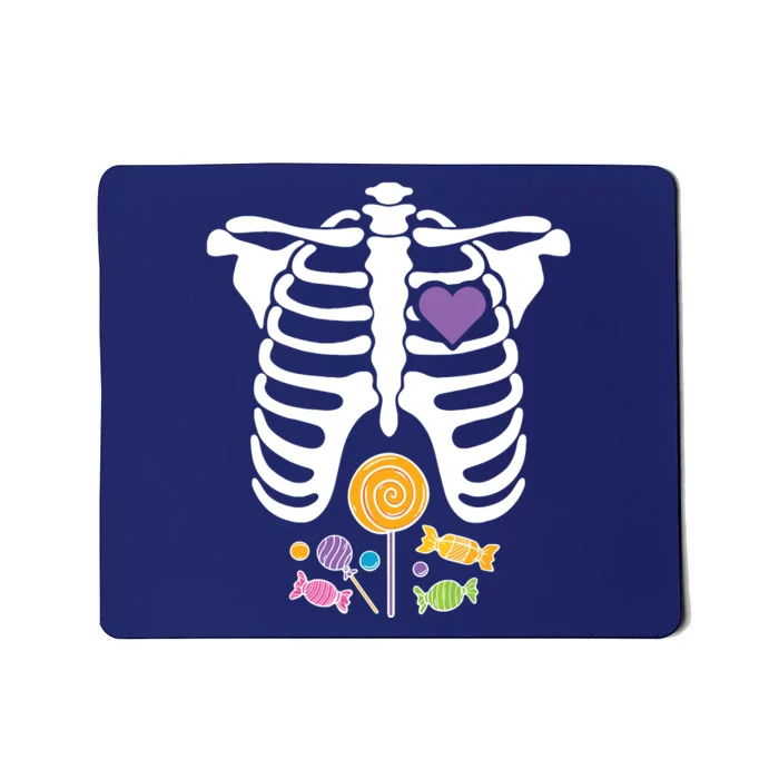 Halloween Candy Xray Skeleton Costume For Kids Boy Mousepad