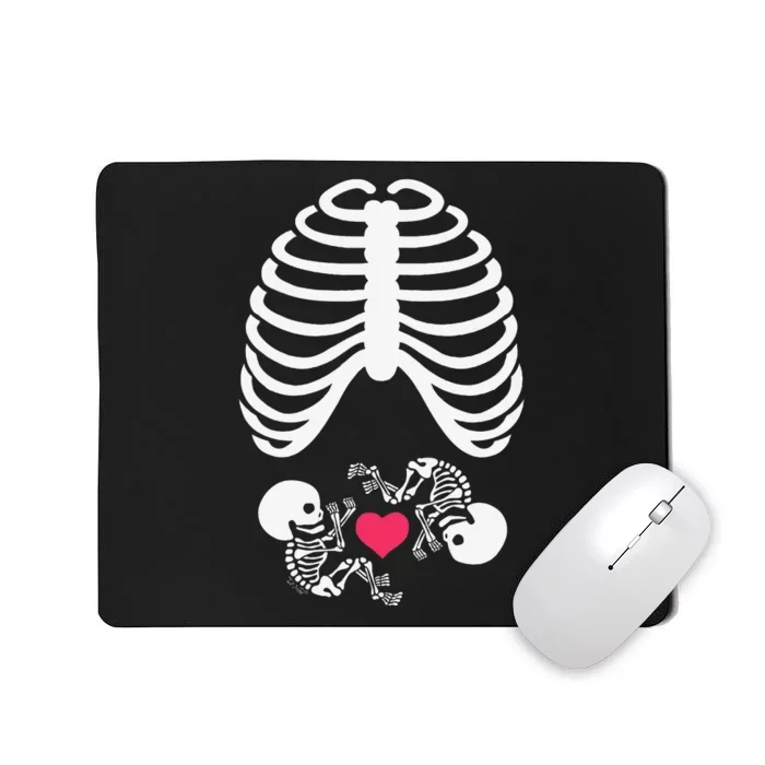 Halloween Rib Cage Pregnancy Expecting Twins Baby Love Mousepad