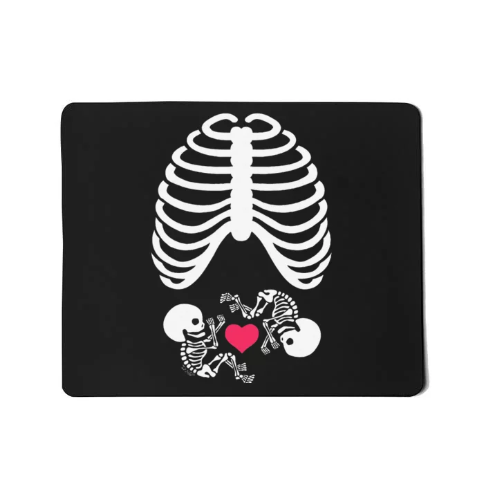 Halloween Rib Cage Pregnancy Expecting Twins Baby Love Mousepad