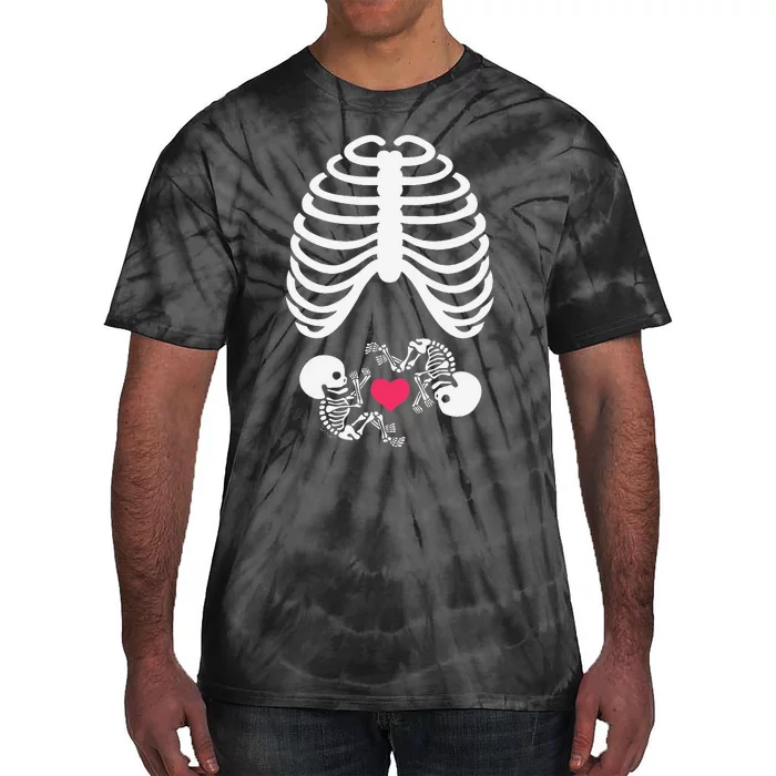 Halloween Rib Cage Pregnancy Expecting Twins Baby Love Tie-Dye T-Shirt