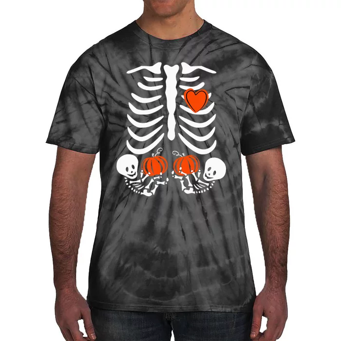 Halloween Skeleton Twins Baby Xray Rib Cage Costume Tie-Dye T-Shirt