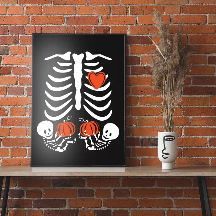 Halloween Twin Pregnant Skeleton Twins Baby Xray Rib Cage Poster