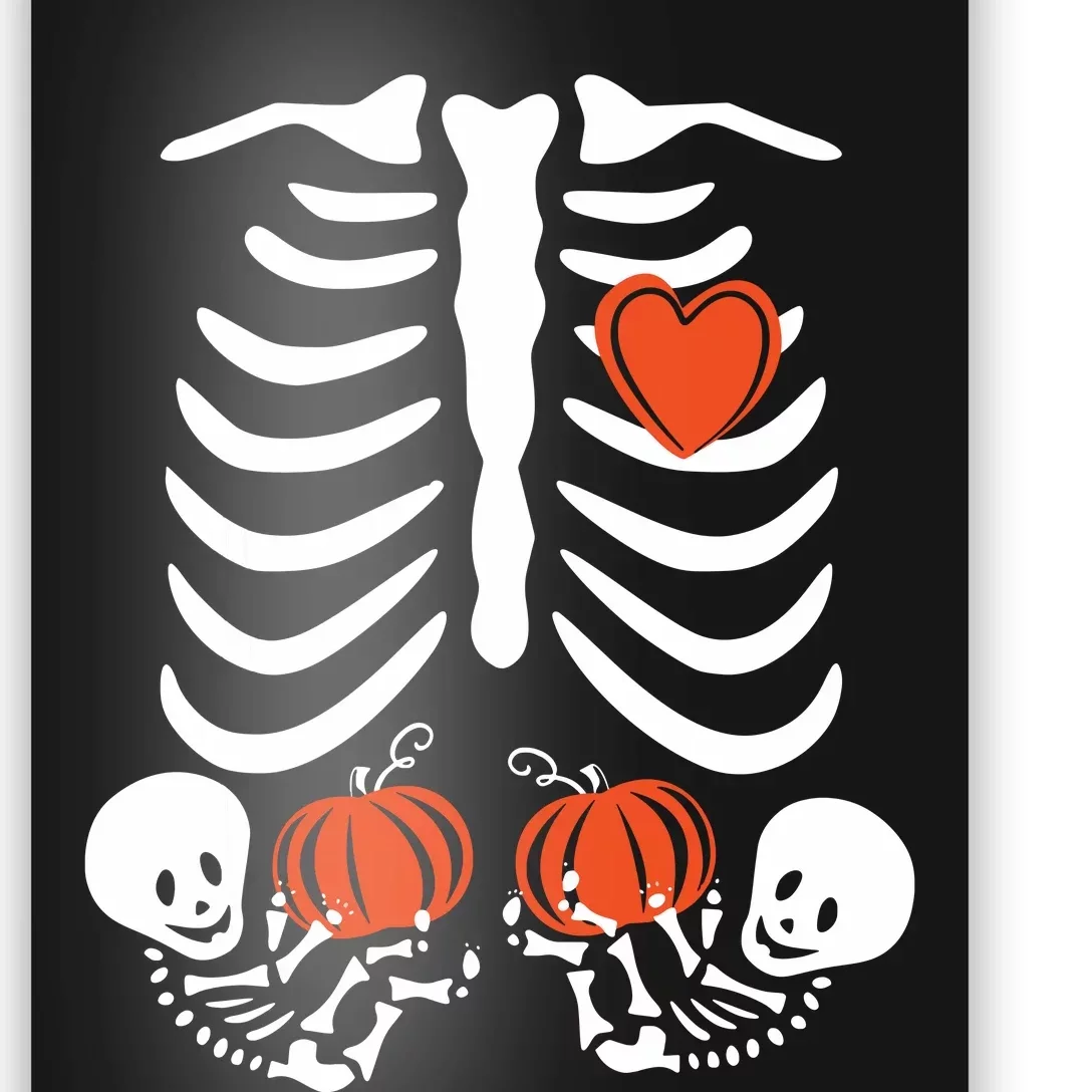 Halloween Twin Pregnant Skeleton Twins Baby Xray Rib Cage Poster