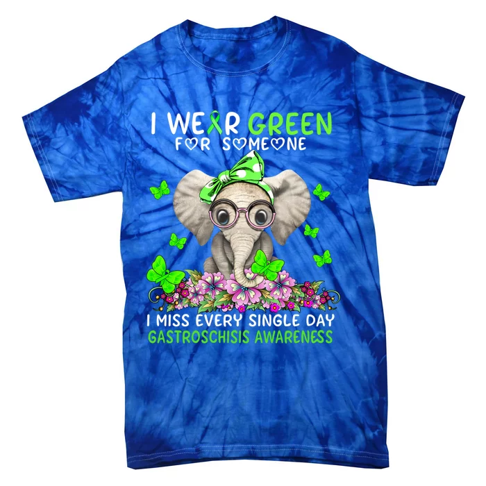 I Miss Every Single Day Gastroschisis Awareness Cute Gift Tie-Dye T-Shirt