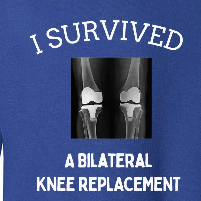 I Survived A Bilateral Knee Replacement Toddler Sweatshirt