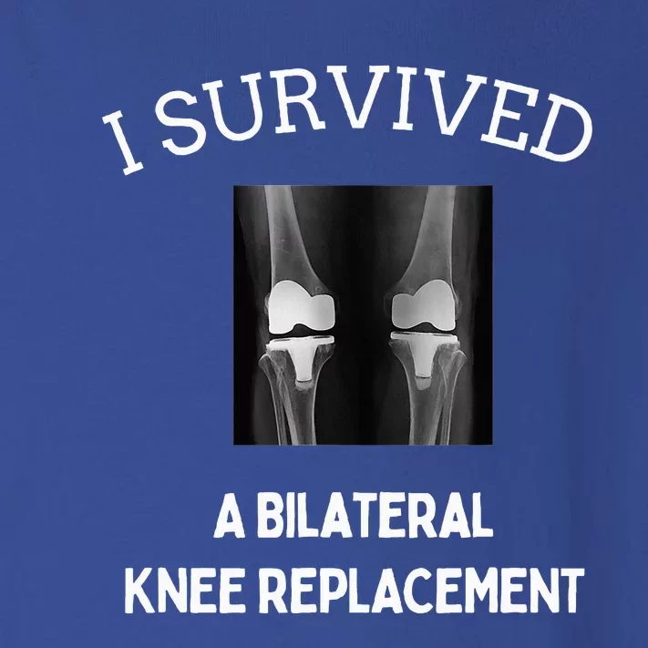 I Survived A Bilateral Knee Replacement Toddler Long Sleeve Shirt