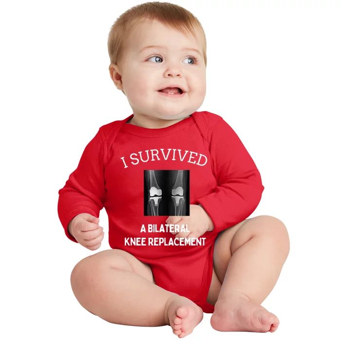 I Survived A Bilateral Knee Replacement Baby Long Sleeve Bodysuit