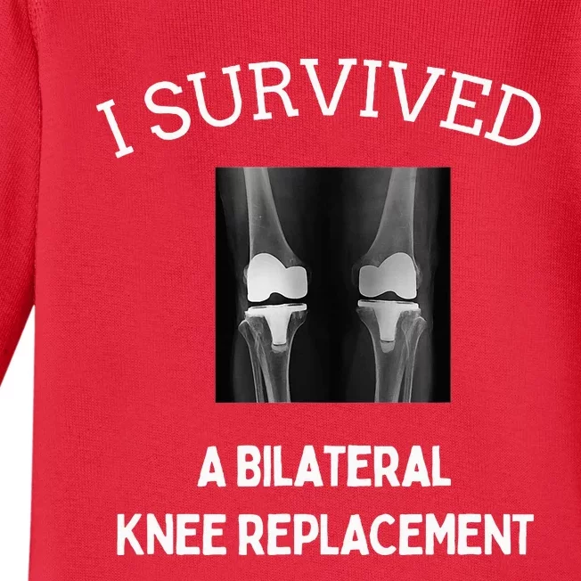 I Survived A Bilateral Knee Replacement Baby Long Sleeve Bodysuit