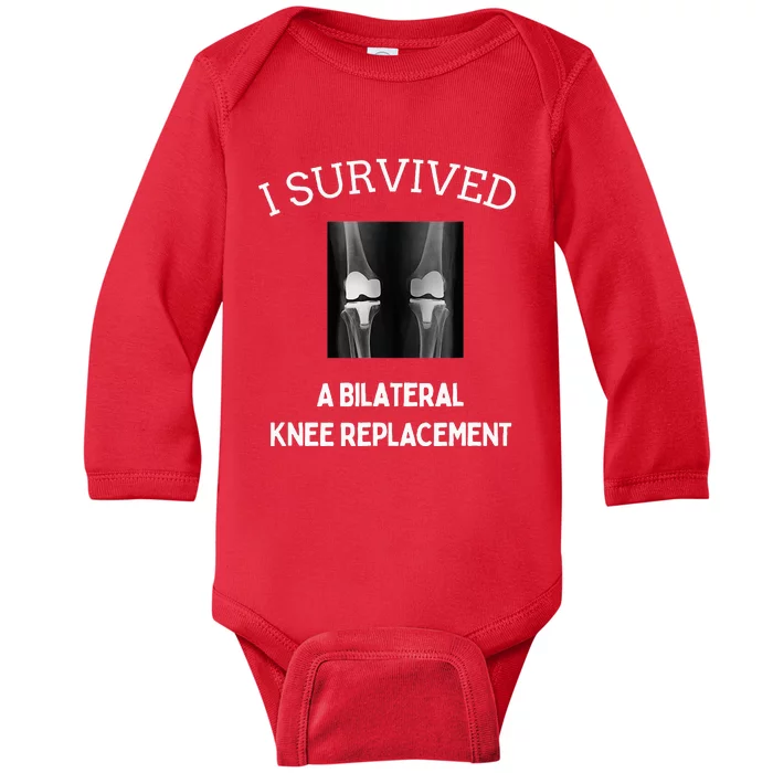 I Survived A Bilateral Knee Replacement Baby Long Sleeve Bodysuit