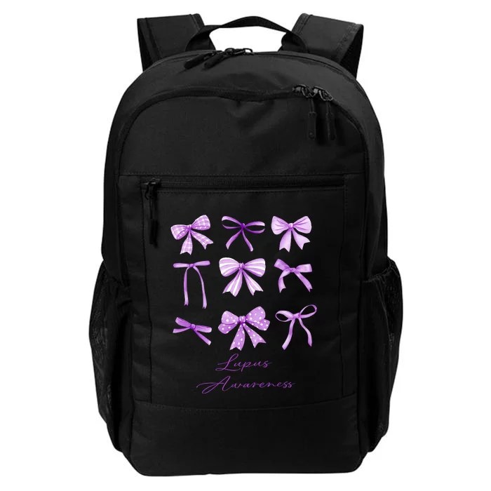 Purple Bow Lupus Awareness Daily Commute Backpack