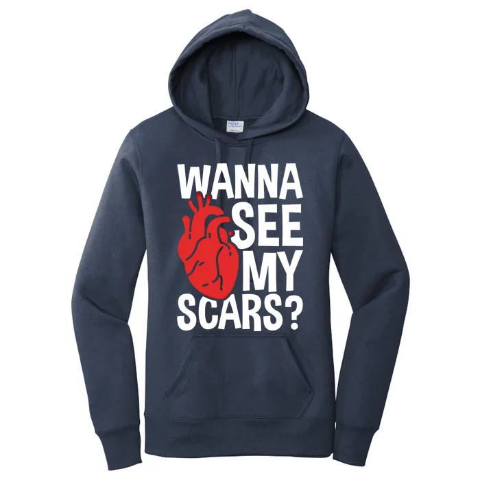 Pre Heart Transplant And After Open Heart Surgery Cool Gift Women's Pullover Hoodie