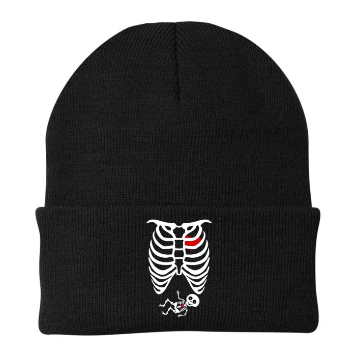 Pregnant Skeleton Knit Cap Winter Beanie