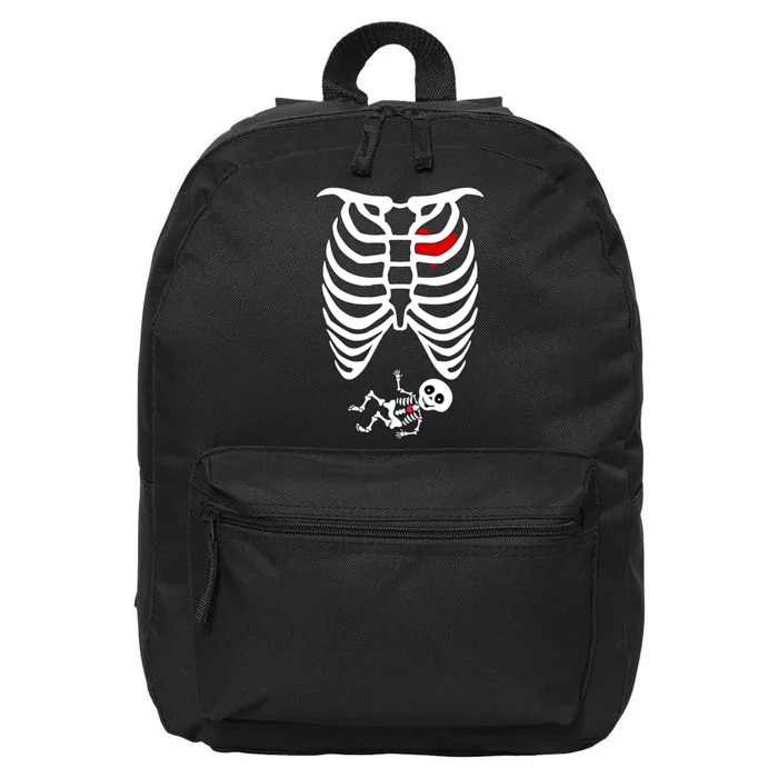 Pregnant Skeleton 16 in Basic Backpack