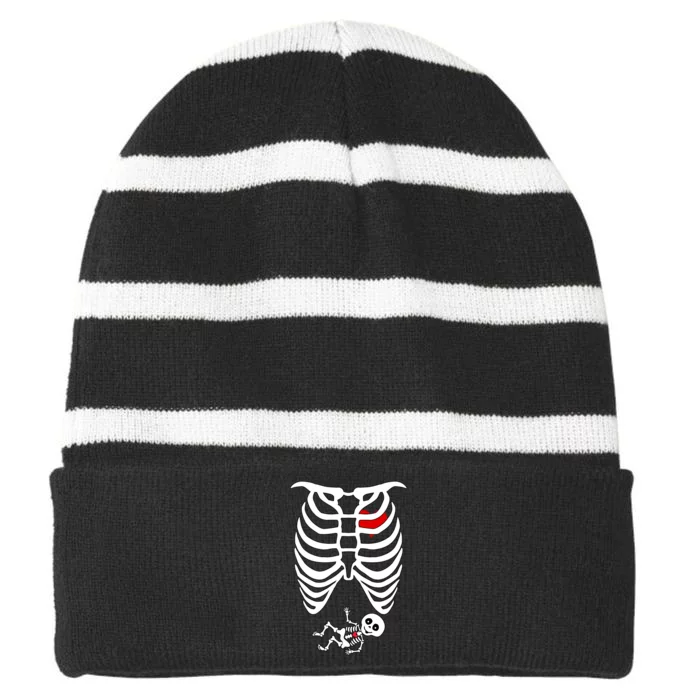 Pregnant Skeleton Striped Beanie with Solid Band