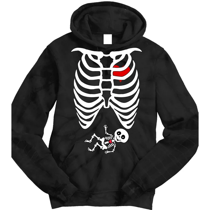 Pregnant Skeleton Tie Dye Hoodie