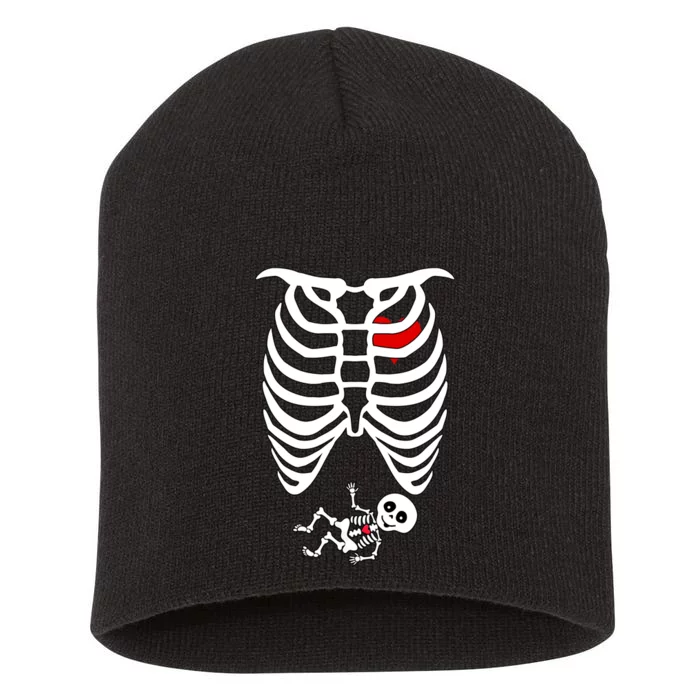 Pregnant Skeleton Short Acrylic Beanie