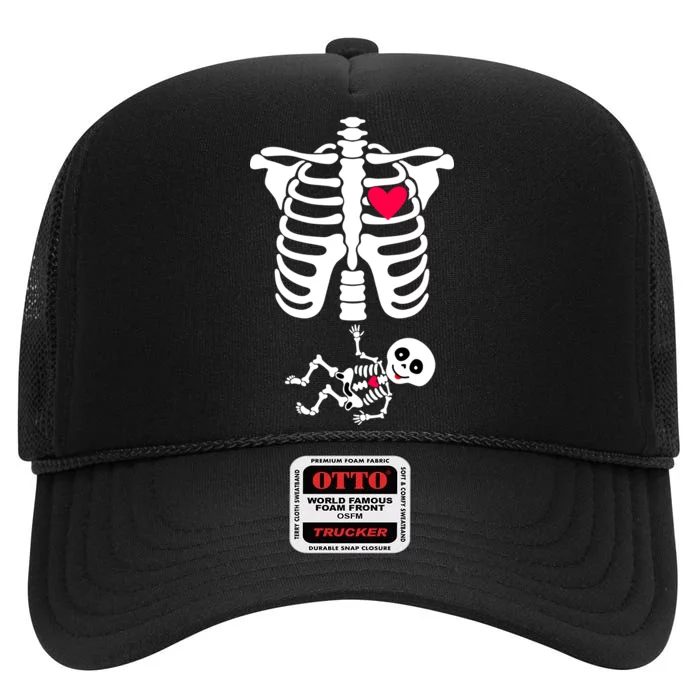 Pregnant Skeleton Ribcage with Baby Costume High Crown Mesh Trucker Hat